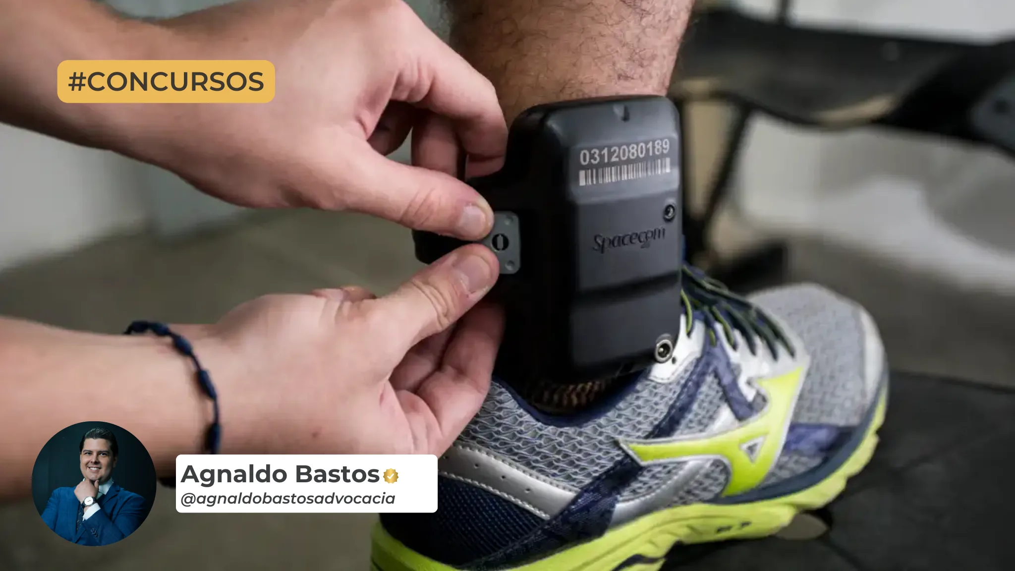 candidato que usar tornozeleira pode fazer concurso